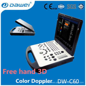 Preço da máquina do eco de DW-C60 2d, preço do ultra-som de Doppler da cor do portátil